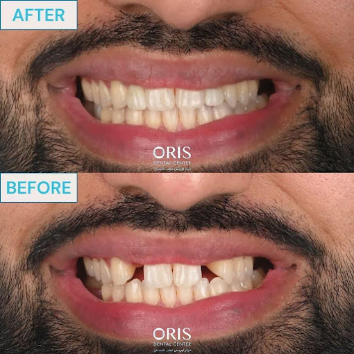 Oris Dental Center Mirdif Dentists in Mirdif Get Contact